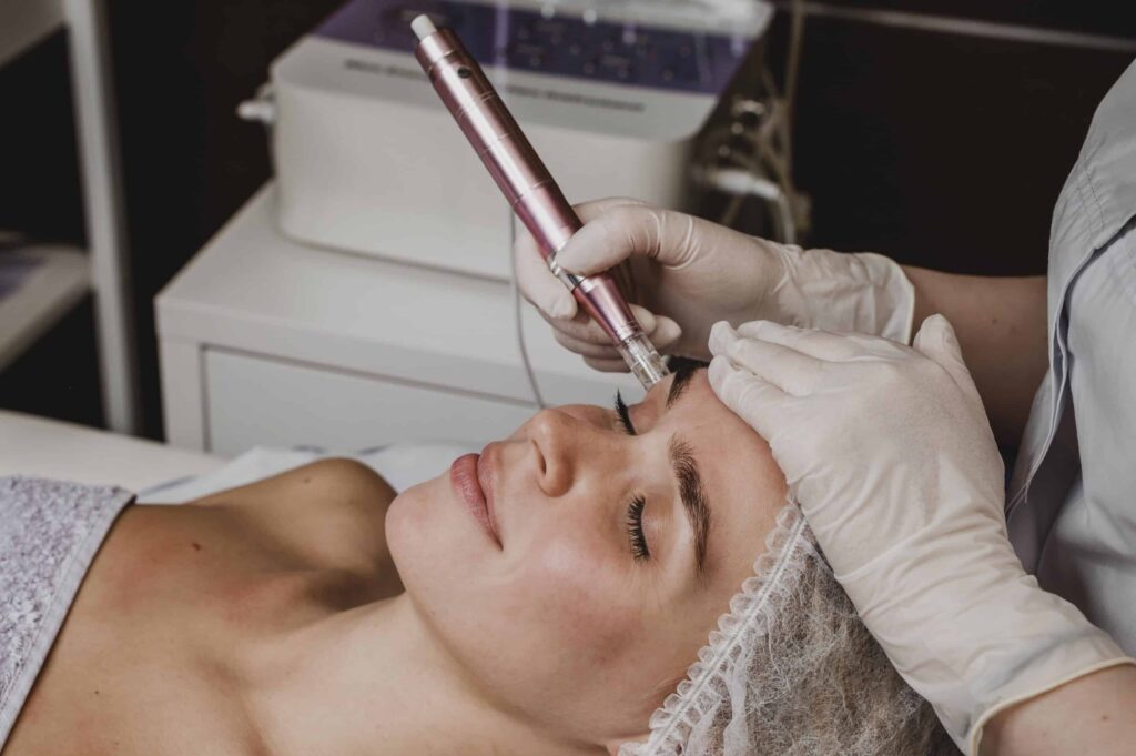 Tratamiento Facial Dermapen