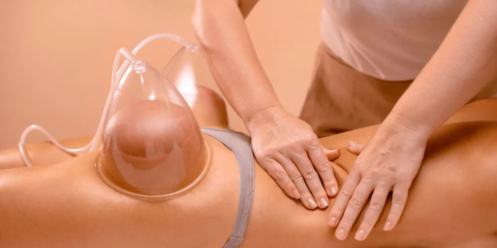 Resultados de reducción de celulitis con ventosas antes y después en Jeisy Quintero