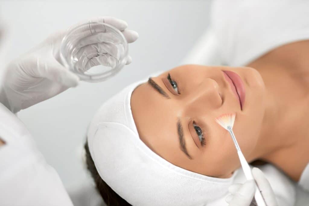 Guía definitiva sobre peeling químico Barcelona