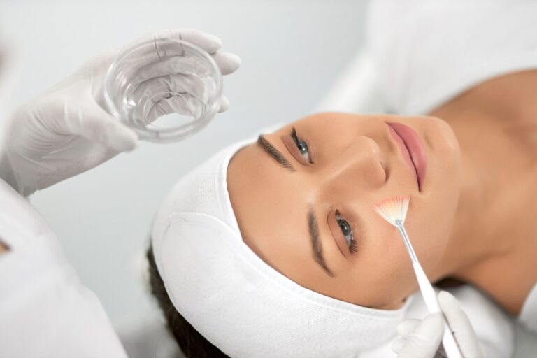 Guía definitiva sobre peeling químico Barcelona